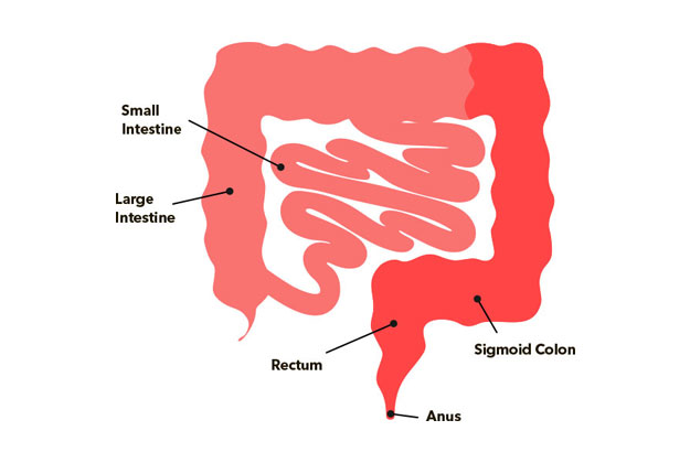 Ulcerative Colitis1,2